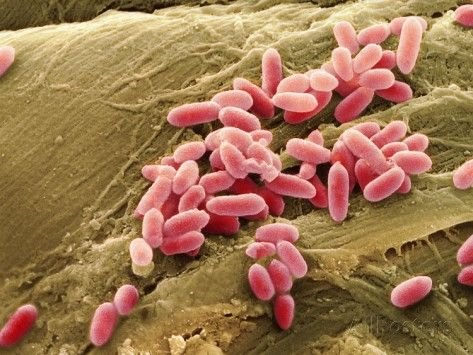 Drug-resistant superbugs projected to kill 39 million by 2050